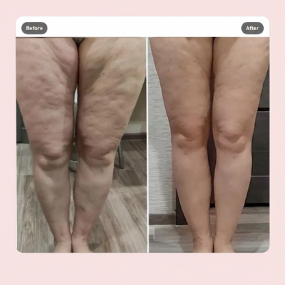 Before after benen roze achtergrond